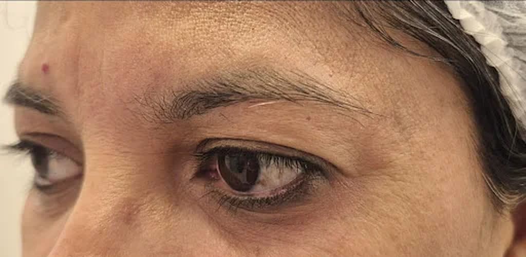 Antes — sobrancelha mais densa e simétrica após micropigmentação